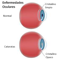 ojo con catartas